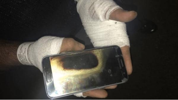 三星手機(jī)又炸：S7爆炸導(dǎo)致男子手二級、手腕三級燒傷